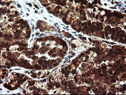 Mannose Phosphate Isomerase Antibody (OTI1C7), Novus Biologicals 0.1mL;