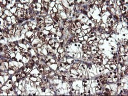 Mannose Phosphate Isomerase Antibody (OTI1C7), Novus Biologicals 0.1mL;