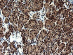 Mannose Phosphate Isomerase Antibody (OTI1C7), Novus Biologicals 0.1mL;