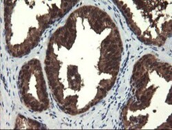 Mannose Phosphate Isomerase Antibody (OTI1C7), Novus Biologicals 0.1mL;