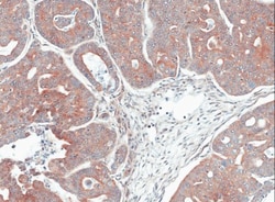 Mannose Phosphate Isomerase Antibody, Novus Biologicals 0.1mg; Unlabeled:Antibodies,