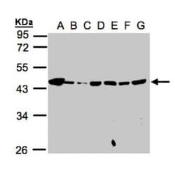 Mannose Phosphate Isomerase Antibody, Novus Biologicals 0.1mg; Unlabeled:Antibodies,