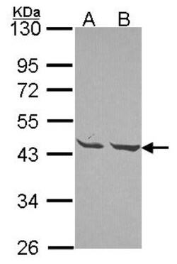Mannose Phosphate Isomerase Antibody, Novus Biologicals 0.1 mL | Buy Online | Novus Biologicals | Fisher Scientific