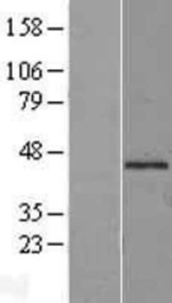 Novus Biologicals&trade;&nbsp;Mannose Phosphate Isomerase Overexpression Lysate