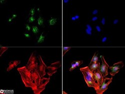 IGF-II R/IGF2R Antibody (2G11) - BSA Free, Novus Biologicals 0.1mL; Unlabeled:Antibodies,