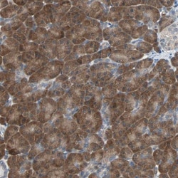 Mannose Phosphate Isomerase Antibody, Novus Biologicals:Antibodies:Primary
