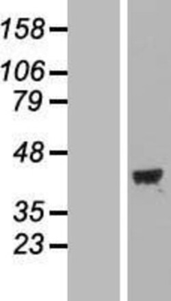 Novus Biologicals™ MAP1 Overexpression Lysate