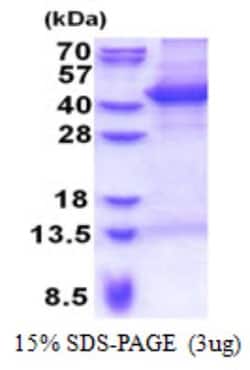 Novus Biologicals&trade;&nbsp;Recombinant Human MAP1 His Protein