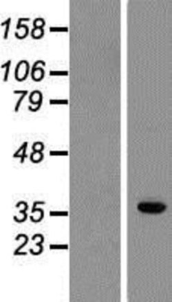 Novus Biologicals&trade;&nbsp;Methionine Aminopeptidase 1D/MAP1D Overexpression Lysate