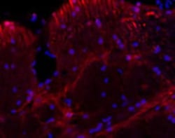 MAP2 Antibody, Novus Biologicals:Antibodies:Primary Antibodies