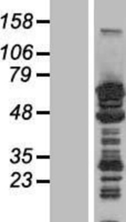 Novus Biologicals™ MAP2 Overexpression Lysate