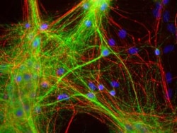 MAP2 Antibody (4H5), Novus Biologicals:Antibodies:Primary Antibodies