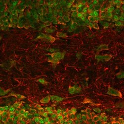 MAP2 Antibody (4H5), Novus Biologicals:Antibodies:Primary Antibodies