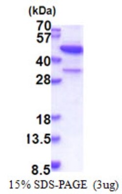 Novus Biologicals&trade;&nbsp;Recombinant Human MAP3K12 binding inhibitory protein 1 His Protein