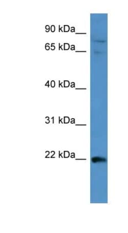 MAP3K15 Antibody, Novus Biologicals 100μL; Unlabeled:Antibodies, Polyclonal