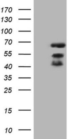MAP3K8/Tpl2/COT Antibody (OTI3D9), Novus Biologicals 0.1 mL | Buy Online | Novus Biologicals | Fisher Scientific