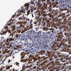 MAP3K9 Antibody, Novus Biologicals:Antibodies:Primary Antibodies