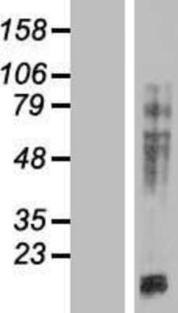 Novus Biologicals&trade;&nbsp;MAP4 Overexpression Lysate