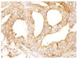 MAP4 Antibody, Novus Biologicals 0.1mL; Unlabeled:Antibodies, Polyclonal