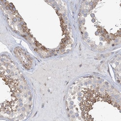 MAP4K5 Antibody, Novus Biologicals 25 &mu;L; Unlabeled:Antibodies, Polyclonal