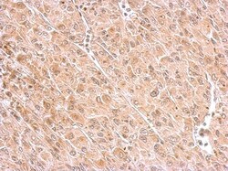 MAP4K6 Antibody, Novus Biologicals 0.1mg; Unlabeled:Antibodies, Polyclonal