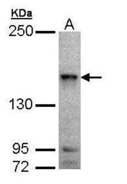 MAP4K6 Antibody, Novus Biologicals 0.1mg; Unlabeled:Antibodies, Polyclonal