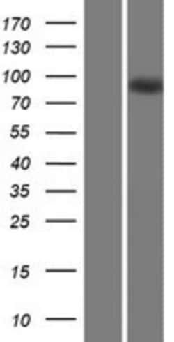 Novus Biologicals&trade;&nbsp;MAP6 Overexpression Lysate
