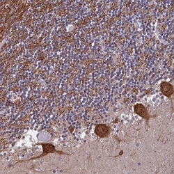 MAP6 Antibody, Novus Biologicals 25 &mu;L, Unlabeled:Antibodies, Polyclonal