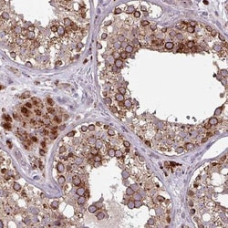MAP7D2 Antibody, Novus Biologicals 25 &mu;L, Unlabeled:Antibodies, Polyclonal