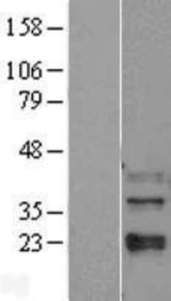Novus Biologicals™ p38 beta/MAPK11 Overexpression Lysate