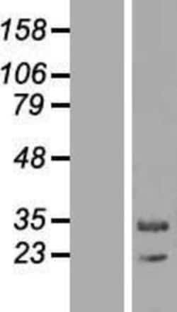 Novus Biologicals&trade;&nbsp;MAPK1IP1L Overexpression Lysate