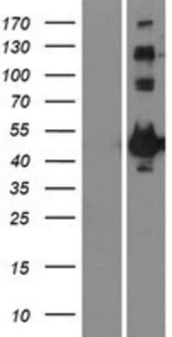 Novus Biologicals&trade;&nbsp;MAPKAPK2 Overexpression Lysate