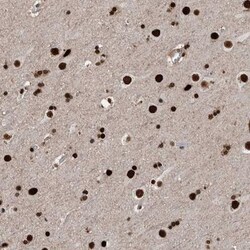MARCH10 Antibody, Novus Biologicals 0.1mL; Unlabeled:Antibodies, Polyclonal