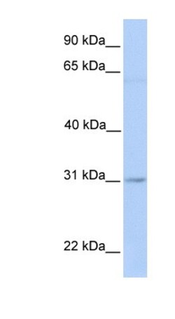 MARCH2 Antibody, Novus Biologicals 100 &mu;L; Unlabeled:Antibodies, Polyclonal