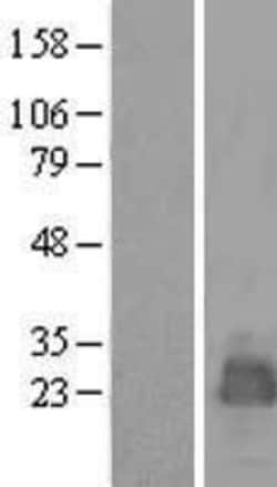 Novus Biologicals&trade;&nbsp;MARCH2 Overexpression Lysate