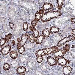 MARCH3 Antibody, Novus Biologicals 25ul | Buy Online | Novus Biologicals | Fisher Scientific