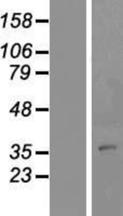 Novus Biologicals&trade;&nbsp;MARCH4 Overexpression Lysate