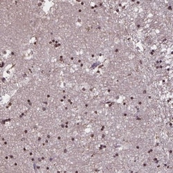 MARCH6 Antibody, Novus Biologicals:Antibodies:Primary Antibodies