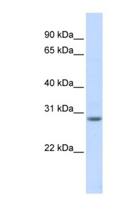 MARCH8 Antibody, Novus Biologicals 100 &mu;L | Buy Online | Novus Biologicals | Fisher Scientific