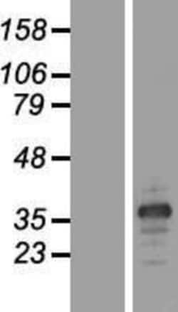 Novus Biologicals™ MARCH8 Overexpression Lysate