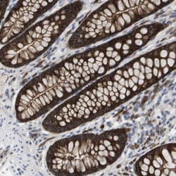 MARCH8 Antibody, Novus Biologicals:Antibodies:Primary Antibodies