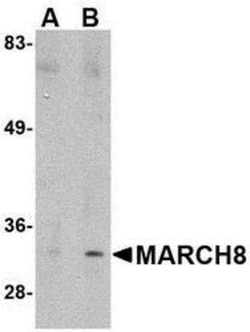 MARCH8 Antibody - BSA Free, Novus Biologicals 0.1mg; Unlabeled:Antibodies,
