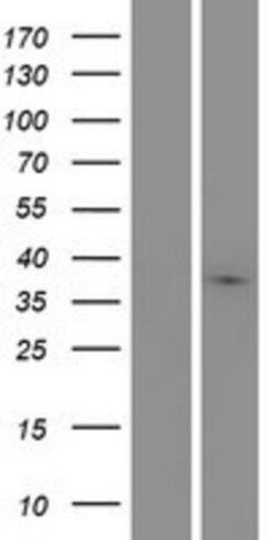 Novus Biologicals™ MARCH9 Overexpression Lysate