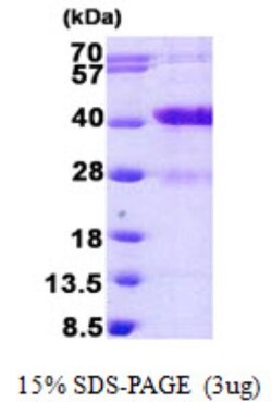 Novus Biologicals&trade;&nbsp;Recombinant Human MARCKS like protein His Protein
