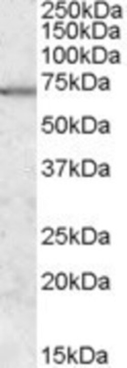 MARK2 Antibody, Novus Biologicals 0.1mg; Unlabeled:Antibodies, Polyclonal