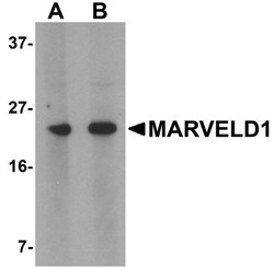 MARVELD1 Antibody - BSA Free, Novus Biologicals 0.1mg; Unlabeled:Antibodies,