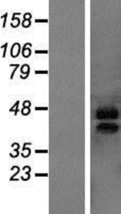 Novus Biologicals&trade;&nbsp;MARVELD3 Overexpression Lysate