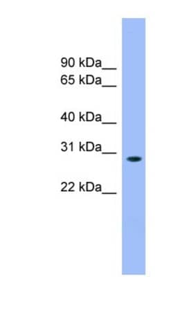 MASA Antibody, Novus Biologicals:Antibodies:Primary Antibodies