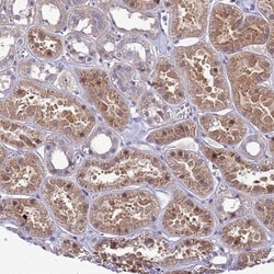 MASA Antibody, Novus Biologicals:Antibodies:Primary Antibodies