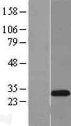 Novus Biologicals™ ASCL1/Mash1 Overexpression Lysate